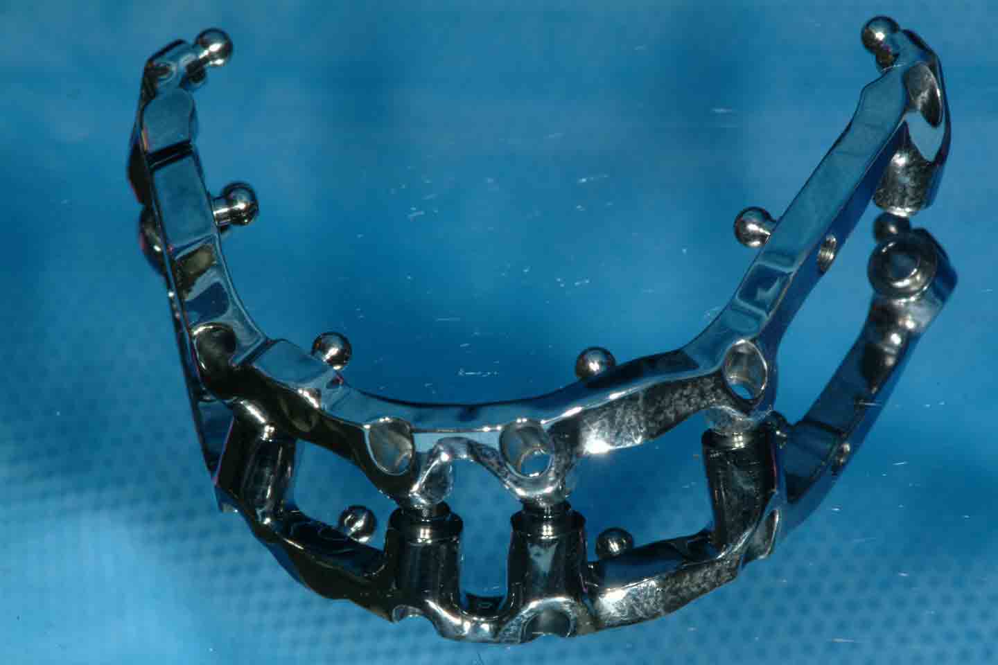 Photo of prosthodontics